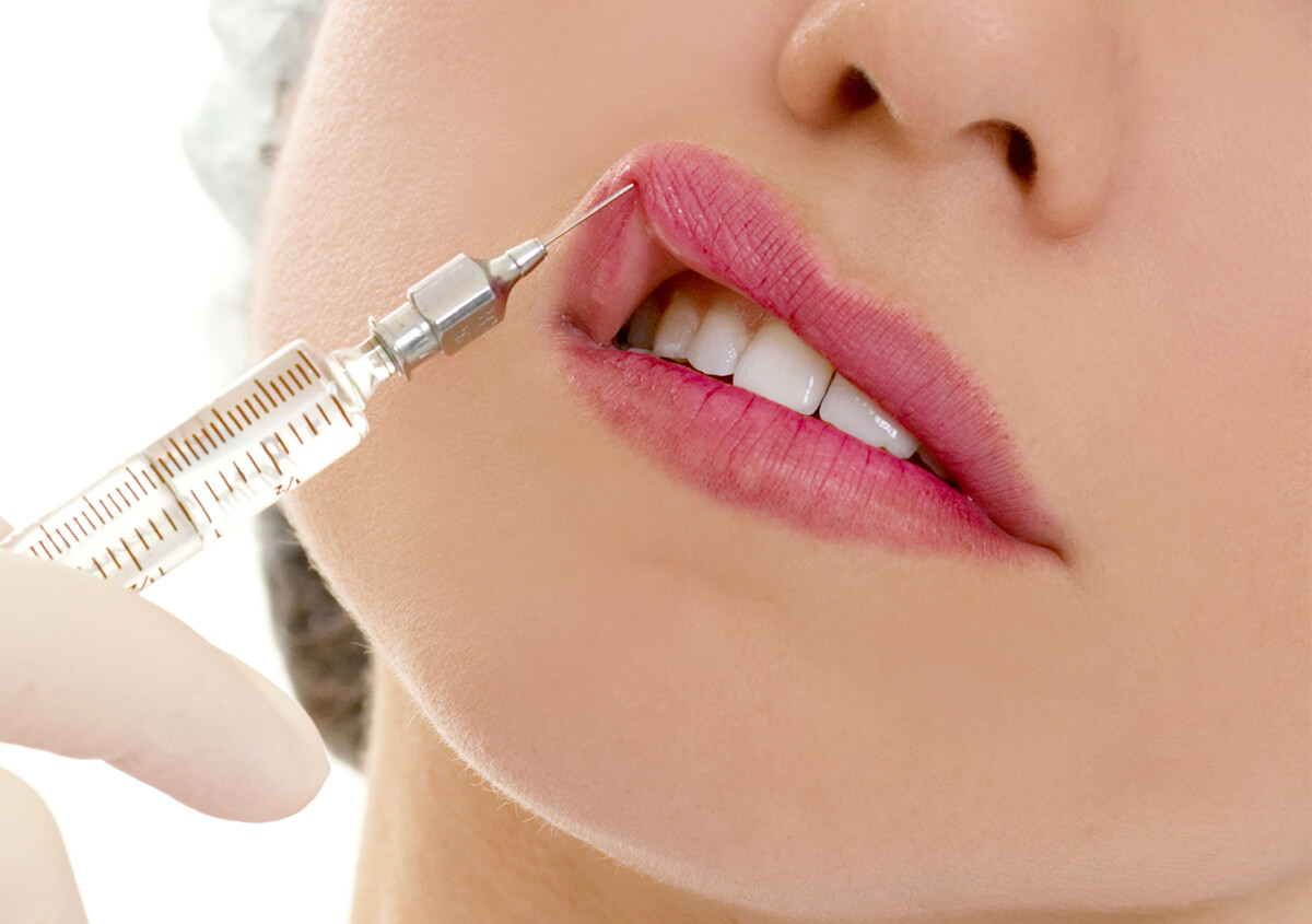 Lip Enhancement Procedures in Guilford CT Area
